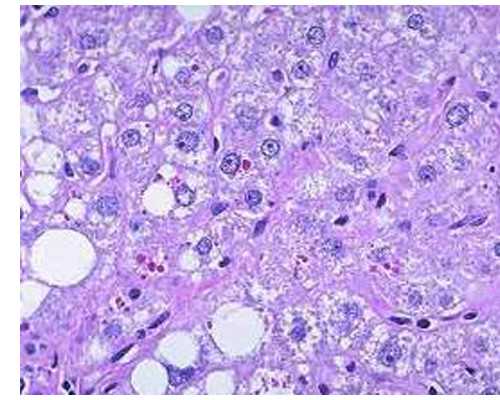 哪里有招供卵试管的,石家庄专业助孕价格-试管助孕机构