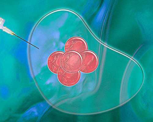 国内试管代怀生子费用一览！附费用明细！